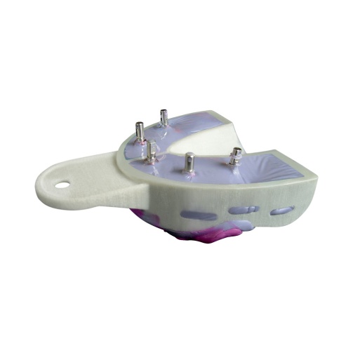 Miratray Implant horní S2 6ks střední